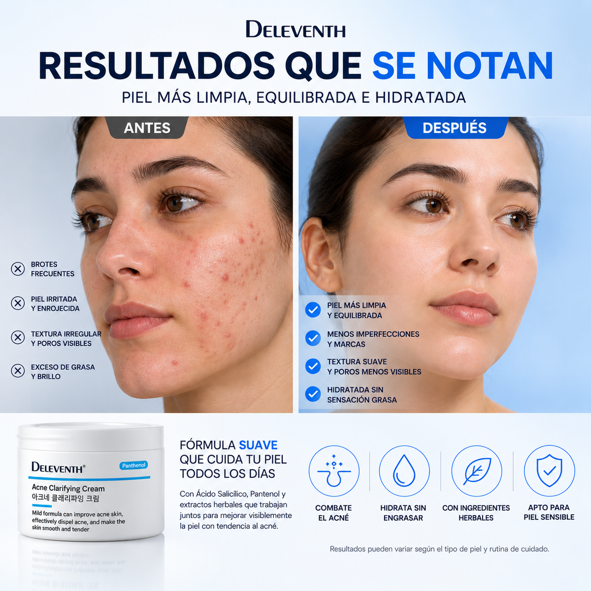 DELEVENTH — CREMA ANTIACNÉ PARA BROTES E IMPERFECCIONES