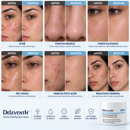 DELEVENTH — CREMA ANTIACNÉ PARA BROTES E IMPERFECCIONES