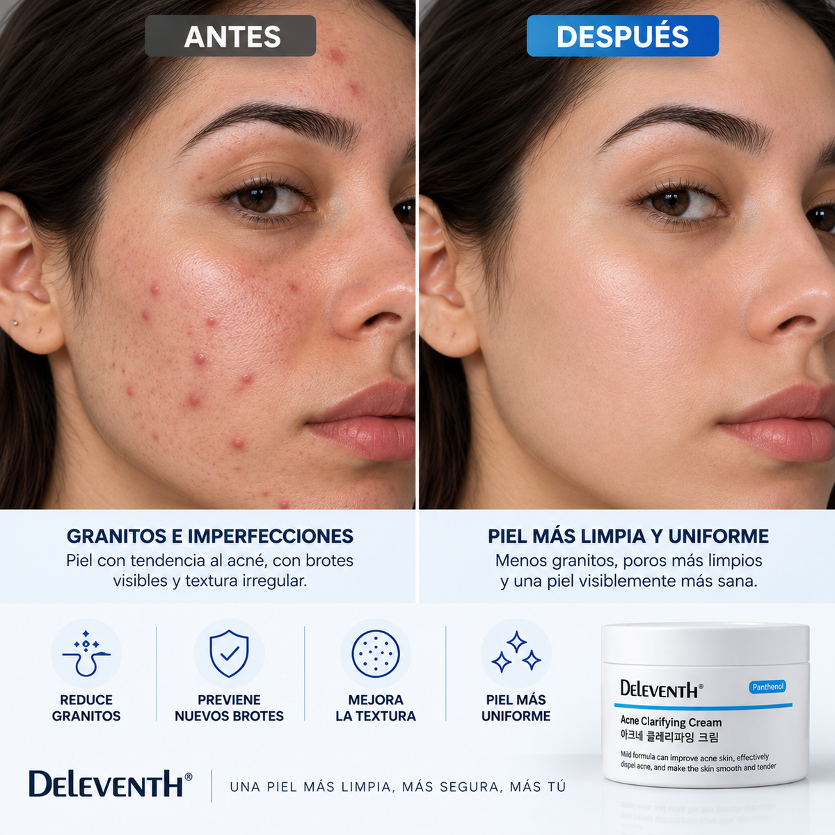 DELEVENTH — CREMA ANTIACNÉ PARA BROTES E IMPERFECCIONES