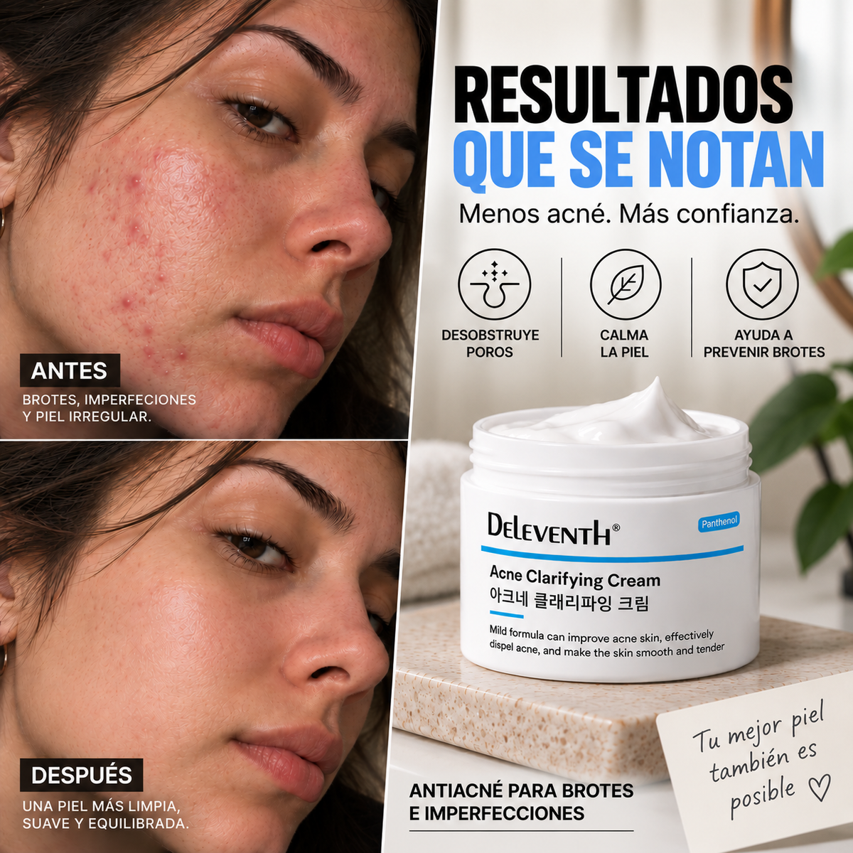 DELEVENTH — CREMA ANTIACNÉ PARA BROTES E IMPERFECCIONES